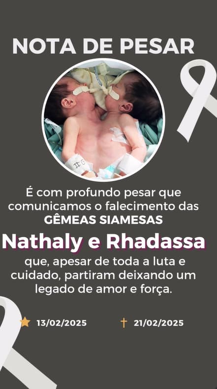 Gêmeas siamesas, Nathaly e Rhadassa