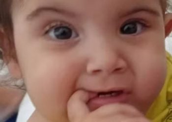 Hospital confirma morte encefálica de Kiraz, uma das gêmeas separadas em Goiânia