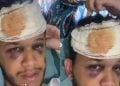 Tudo sobre o acidente que deixou sertanejo com traumatismo craniano