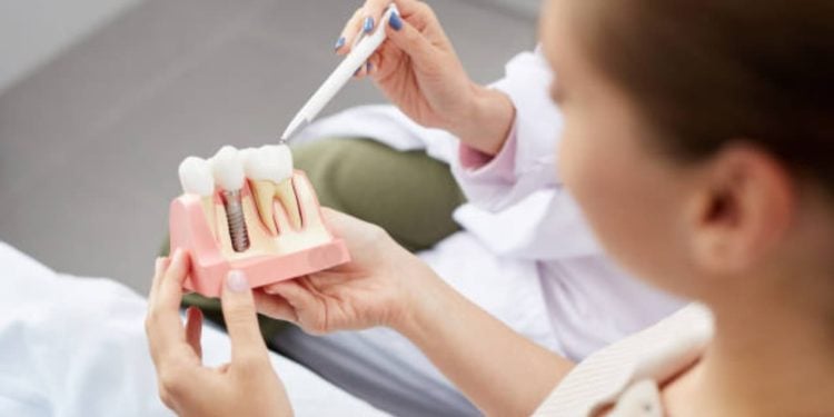 Prótese unitária ou implante dentário? Clínica Hitoshi esclarece o que realmente importa nessa escolha