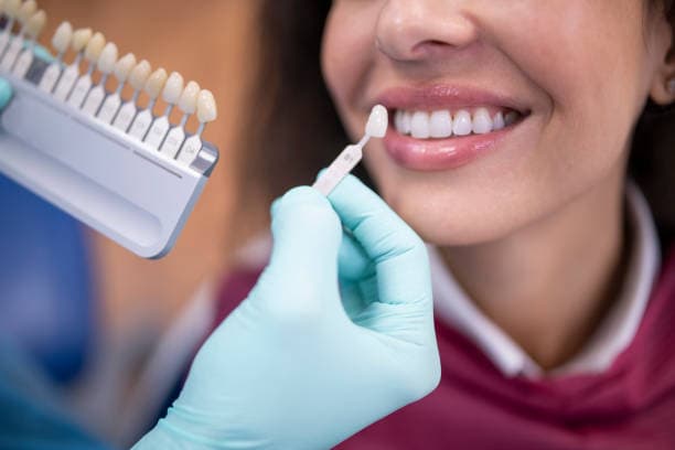 Prótese unitária ou implante dentário? Clínica Hitoshi esclarece o que realmente importa nessa escolha