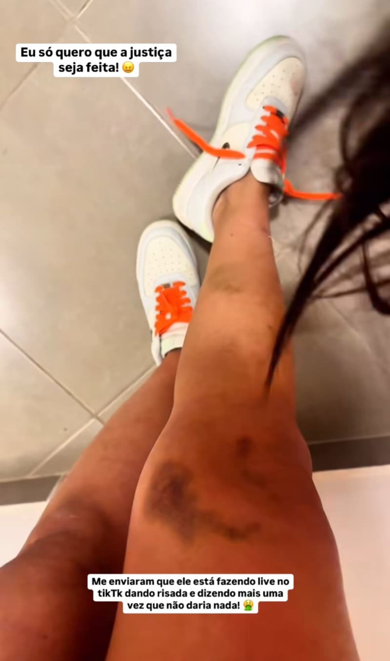 Funkeira denuncia agressões