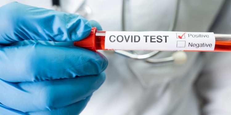 Caos de covid-19 leva à suspensão temporária de atividades na Câmara de Jataí