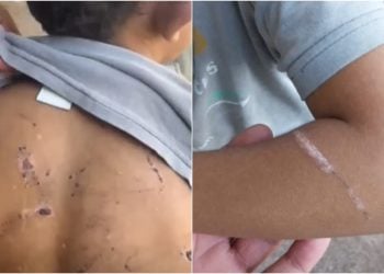 Pai é preso suspeito de agredir filhos e torturá-los com choques, em Goiânia