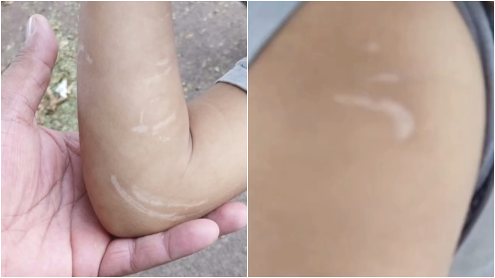 pai suspeito de agredir os filhos